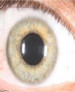 עין חומצית בגוון כחול לבן